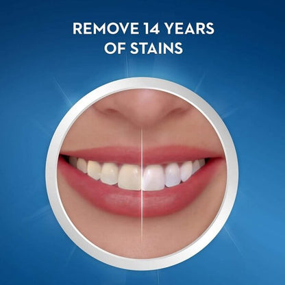 Before and after smile showing results of Crest 3D Whitestrips, removing 14 years of stains.