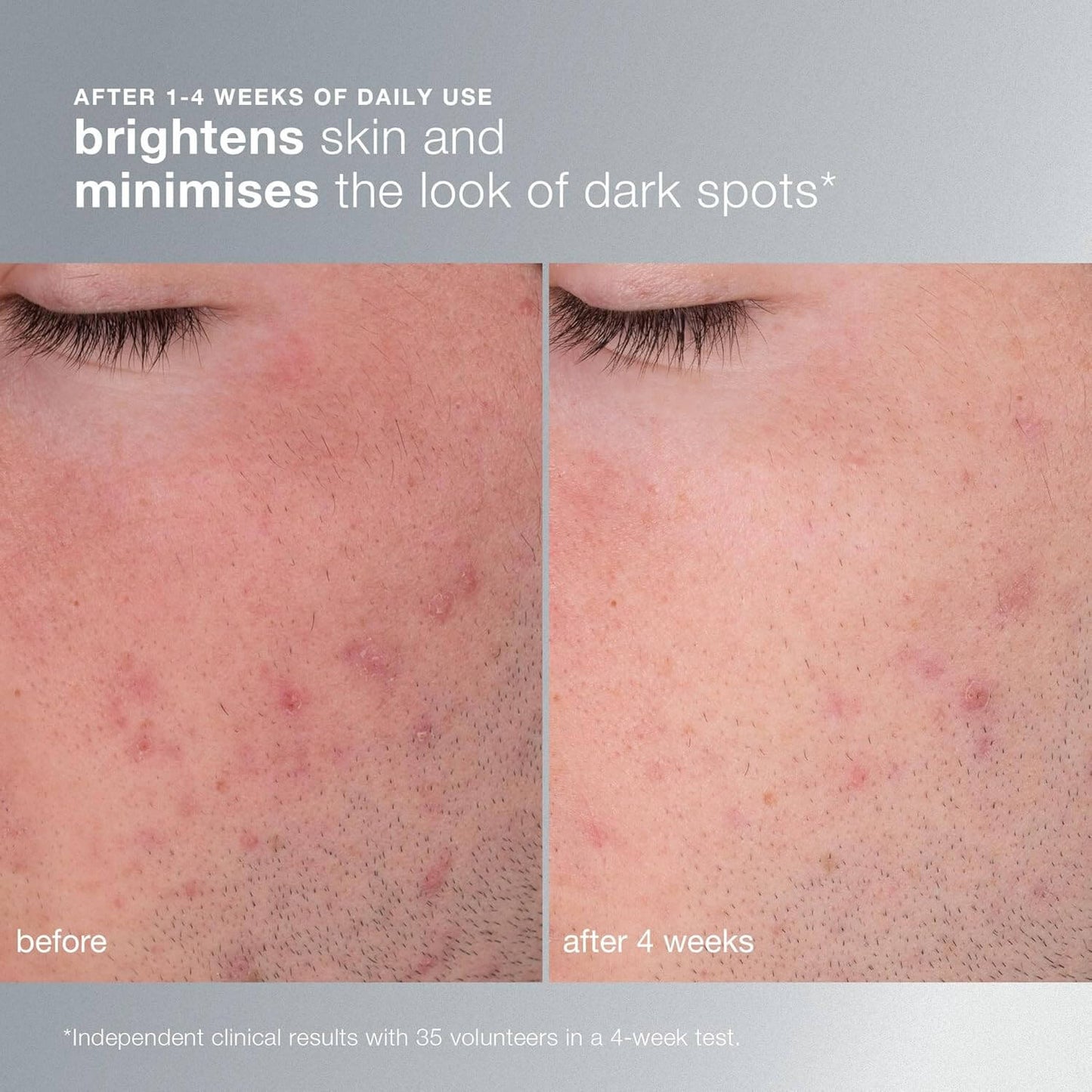 Before and after skin comparison showing brightening effect with Dermalogica text on a gray background