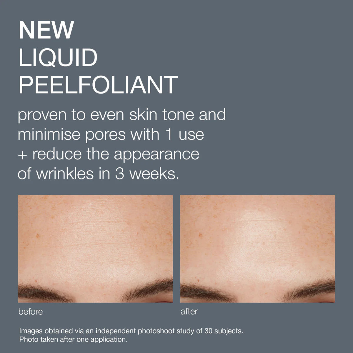 Advertisement for a dermalogica new liquid peelfoliant with before and after skin comparison on a gray background.