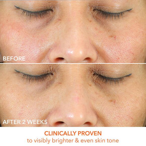 Before and after comparison showing improved skin tone and brightness after using Drunk Elephant T.L.C. Framboos Serum.