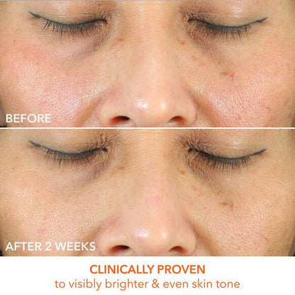 Before and after comparison showing improved skin tone and brightness after using Drunk Elephant T.L.C. Framboos Serum.