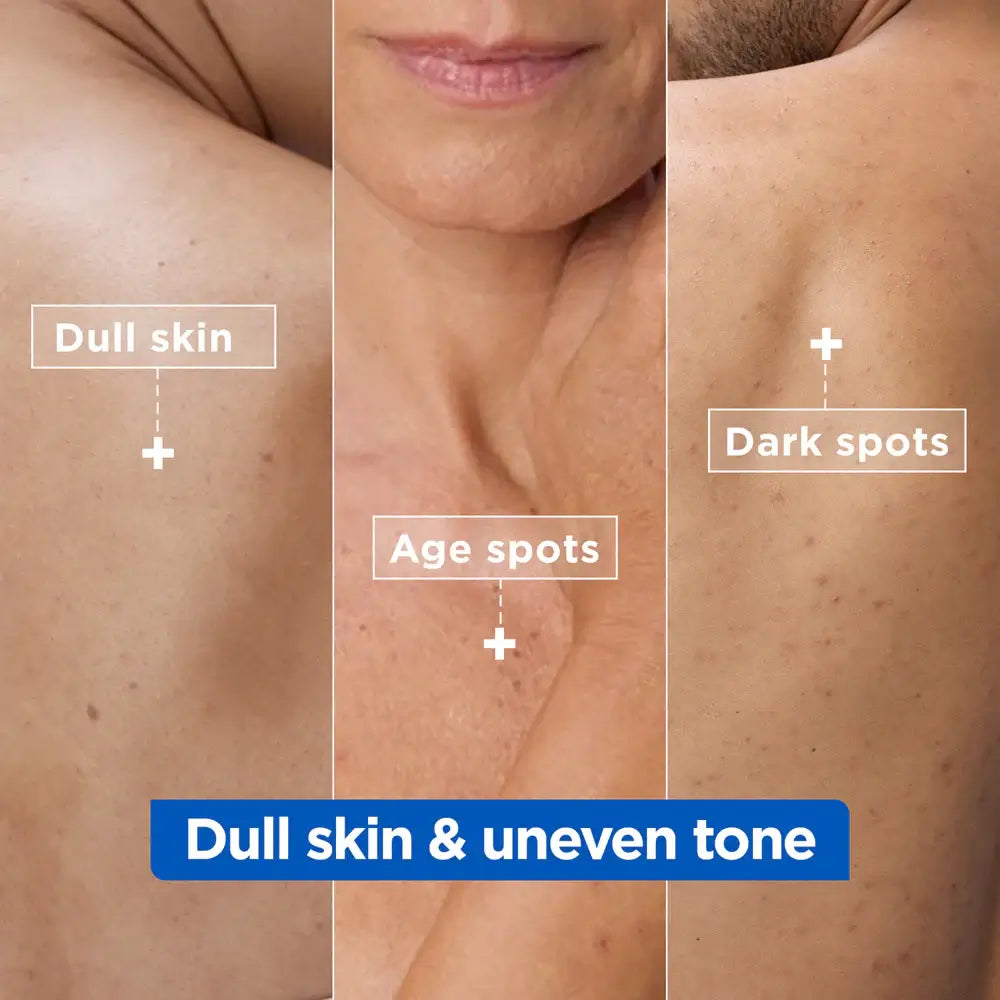 Mixa Comparison of dull skin, age spots, and dark spots on a person's shoulder and neck.