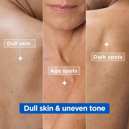 Mixa Comparison of dull skin, age spots, and dark spots on a person's shoulder and neck.