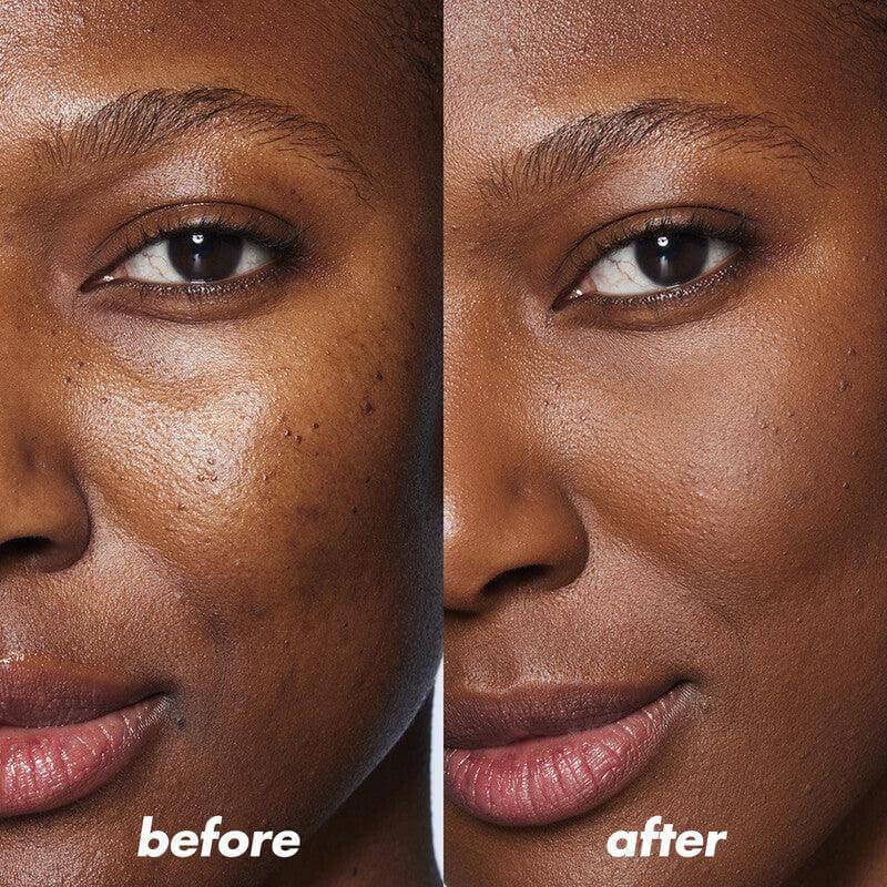 Before and after image showcasing the e.l.f Camo Color Corrector's effect on uneven skin tone and blemishes.