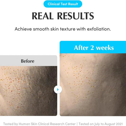 Before and after comparison of skin texture with Eqqualberry exfoliation, showing smooth skin after 2 weeks.
