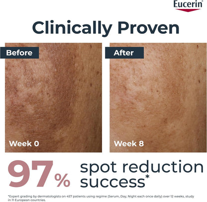 Before and after comparison of skin spots with Eucerin branding, showing 97% spot reduction success.