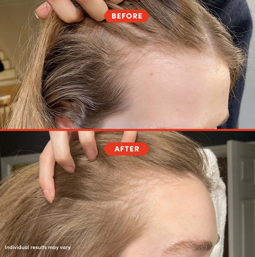 Before and after Fable & Mane comparison of hair care treatment on a person's head.