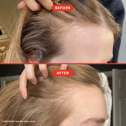 Before and after Fable & Mane comparison of hair care treatment on a person's head.
