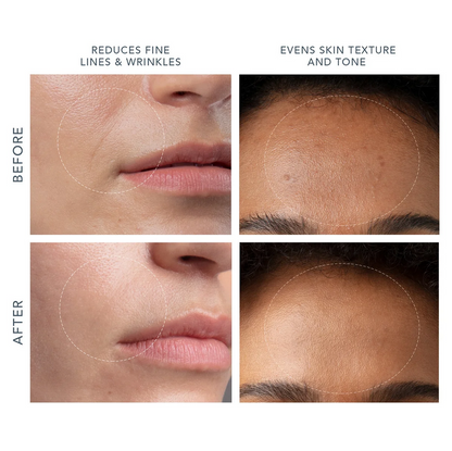Before and after comparison of skin texture and tone reduction with text labels.