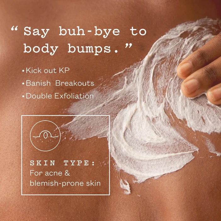 A close-up of a hand applying white exfoliating cream onto tan skin, with promotional text reading “Say buh-bye to body bumps.” and “SKIN TYPE: For acne & blemish-prone skin.