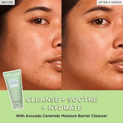 Glow Recipe Fruit Babies Set transformation before and after using Avocado Ceramide Moisture Barrier Cleanser.