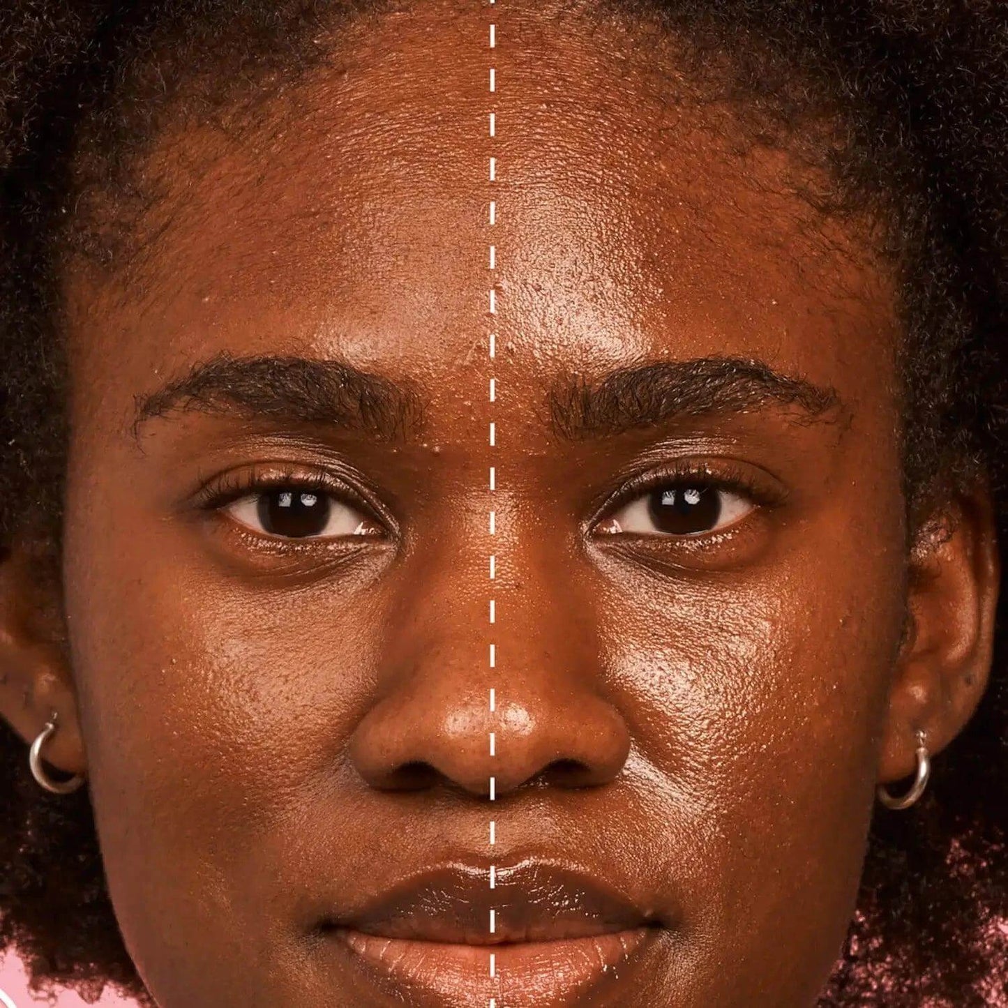 Before and after comparison of skin texture and oil control using GLOW RECIPE Strawberry BHA Pore-Smooth Blur Drops.