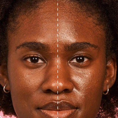 Before and after comparison of skin texture and oil control using GLOW RECIPE Strawberry BHA Pore-Smooth Blur Drops.