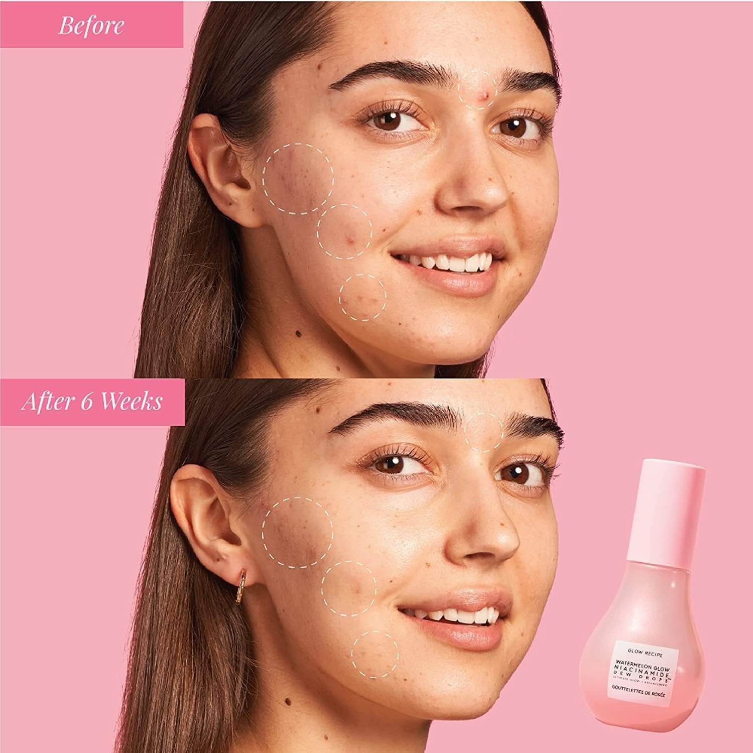 Before and after comparison of a woman's face with a Glow Recipe skincare product on a pink background