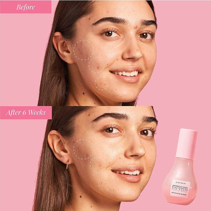 Before and after comparison of a woman's face with a Glow Recipe skincare product on a pink background