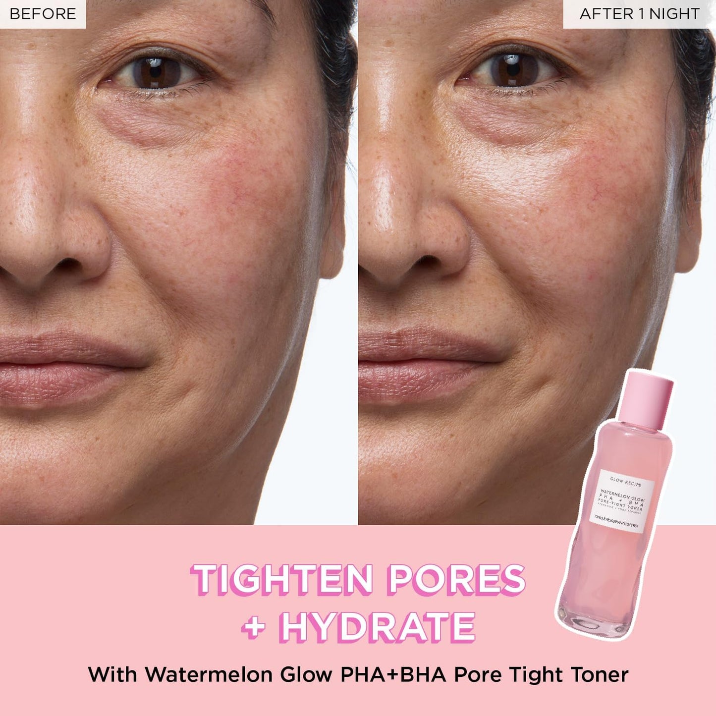 Glow Recipe Fruit Babies Set results: before and after one night of using Watermelon Glow PHA+BHA Pore Tight Toner.