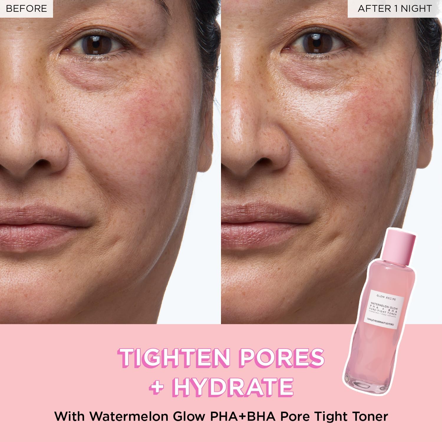 Glow Recipe Fruit Babies Set results: before and after one night of using Watermelon Glow PHA+BHA Pore Tight Toner.