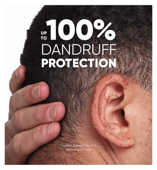 Head & Shoulders Classic Clean 2in1 Anti Dandruff Shampoo 250ml offers up to 100% dandruff protection.