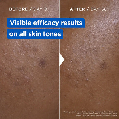 Before and after Mixa skin treatment comparison on a brown background with text indicating visible efficacy results.