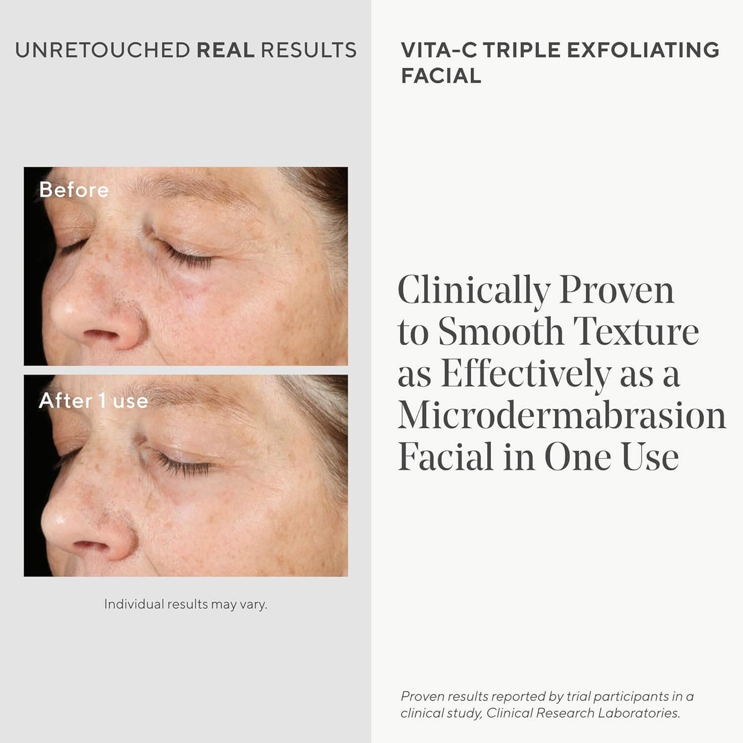 Before and after effects of a Murad VITA-C triple exfoliating facial treatment on skin texture.