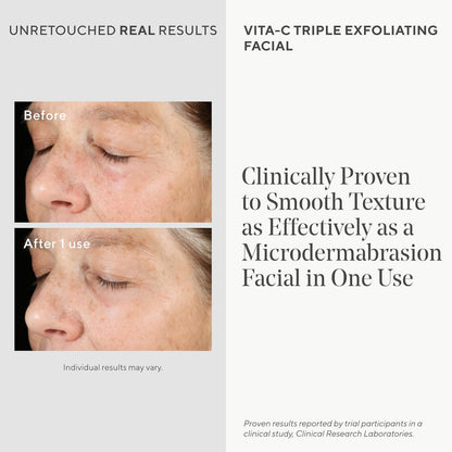 Before and after effects of a Murad VITA-C triple exfoliating facial treatment on skin texture.