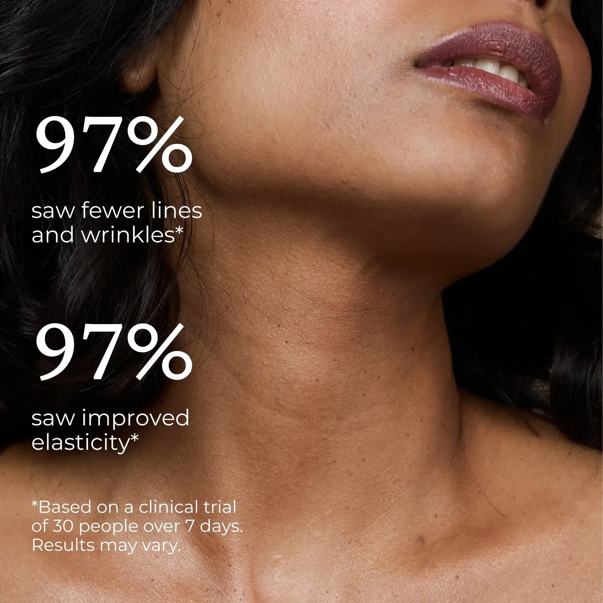 Close-up of a woman's neck with text indicating skin improvement results with PRAI .
