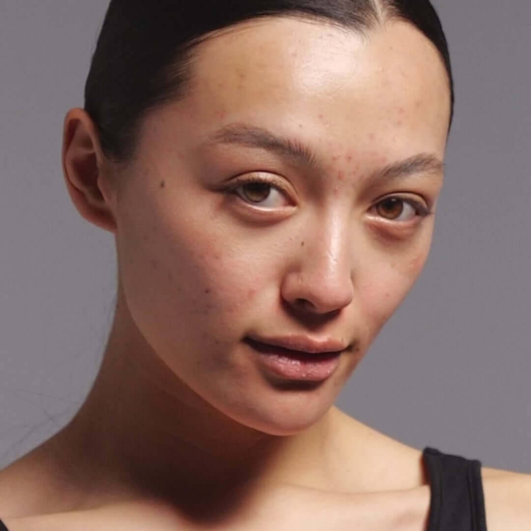 Model with blemish-prone skin showcasing the benefits of The Inkey List Targeted Blemish Duo for clear skin.