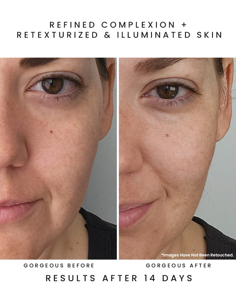 Before and after comparison of a woman's face with text indicating Earth Harbor skin refinement and improvement.
