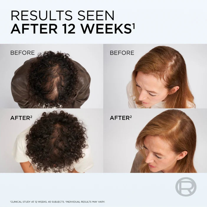 Before and after results of a hair treatment or product application on two individuals' heads.