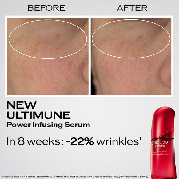 Before and after results of Shiseido Ultimune Power Infusing Serum showing wrinkle reduction in 8 weeks.