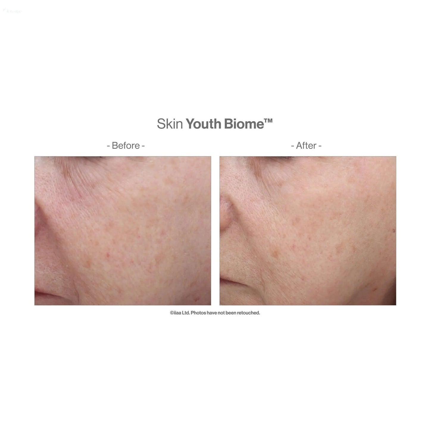 Before and after results of Advanced Nutrition Programme Skin Youth Biome showing improved skin texture.