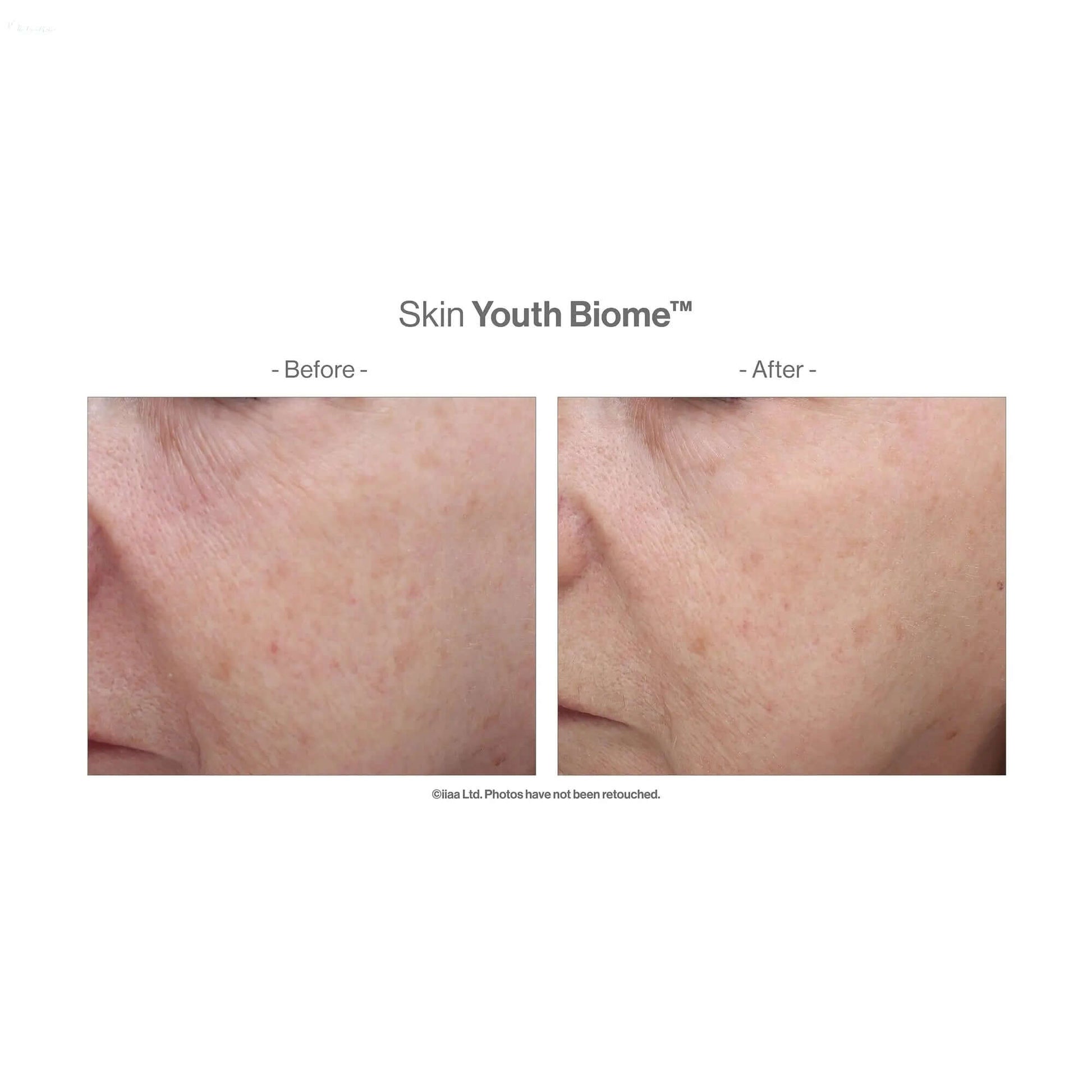 Before and after results of Advanced Nutrition Programme Skin Youth Biome showing improved skin texture.