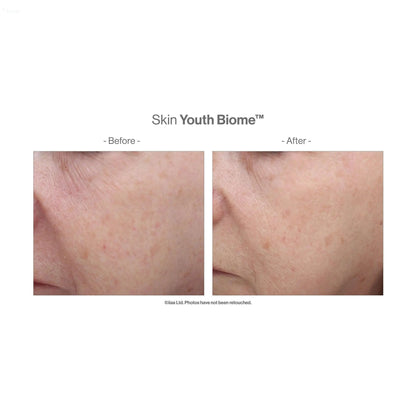 Before and after results of Advanced Nutrition Programme Skin Youth Biome showing improved skin texture.