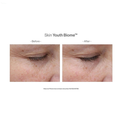 Before and after results showing skin improvement with Advanced Nutrition Skin Youth Biome™ capsules.