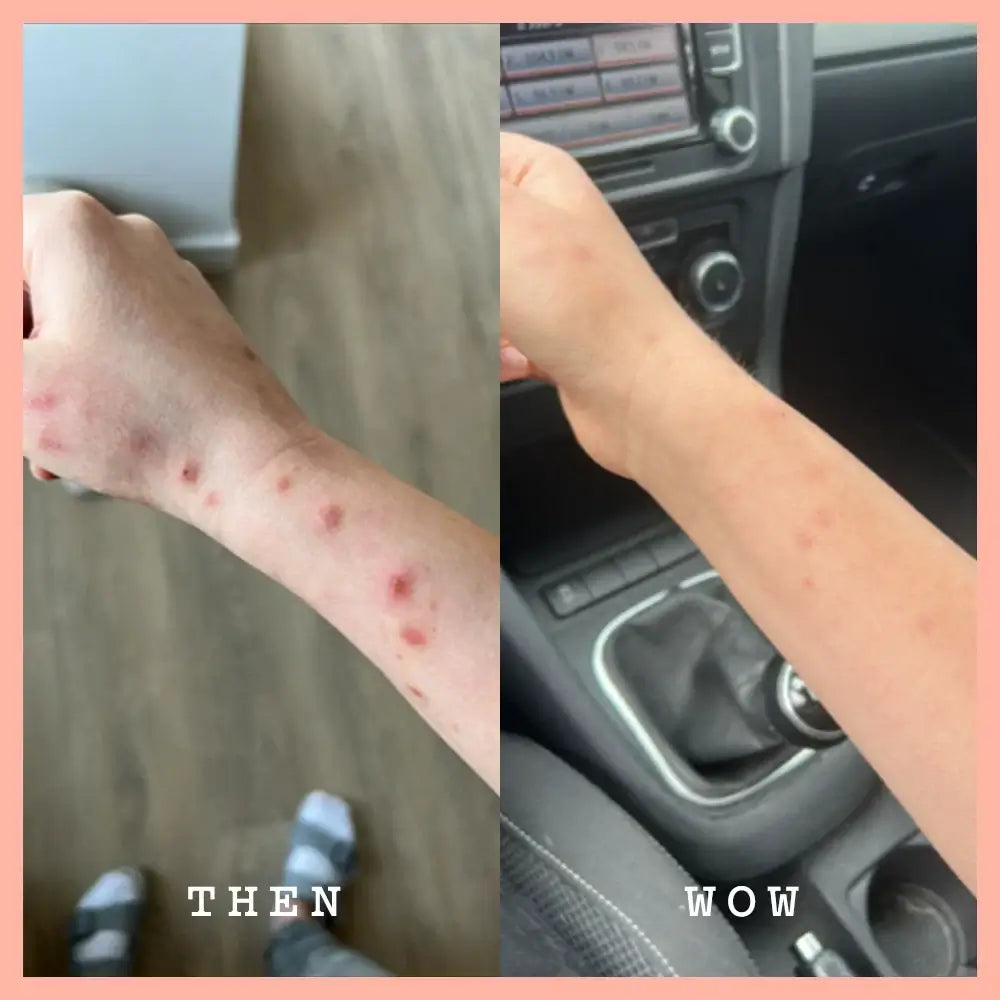Before and after comparison of a person's arm with visible skin conditions inside a car.