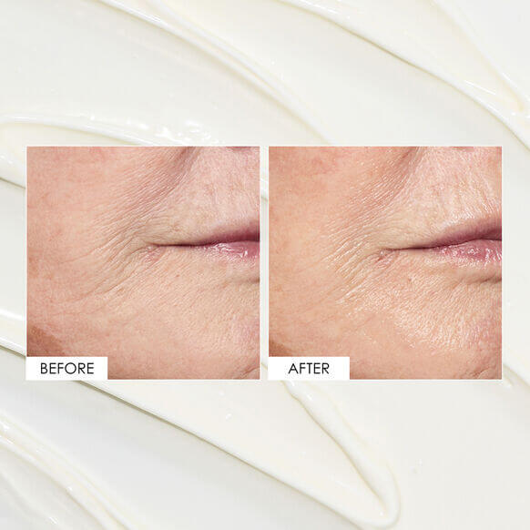 Before and after comparison of skin texture improvement, showcasing hydration effects of Sunday Riley ICE Ceramide Moisturizing Cream.