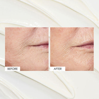 Before and after comparison of skin texture improvement, showcasing hydration effects of Sunday Riley ICE Ceramide Moisturizing Cream.