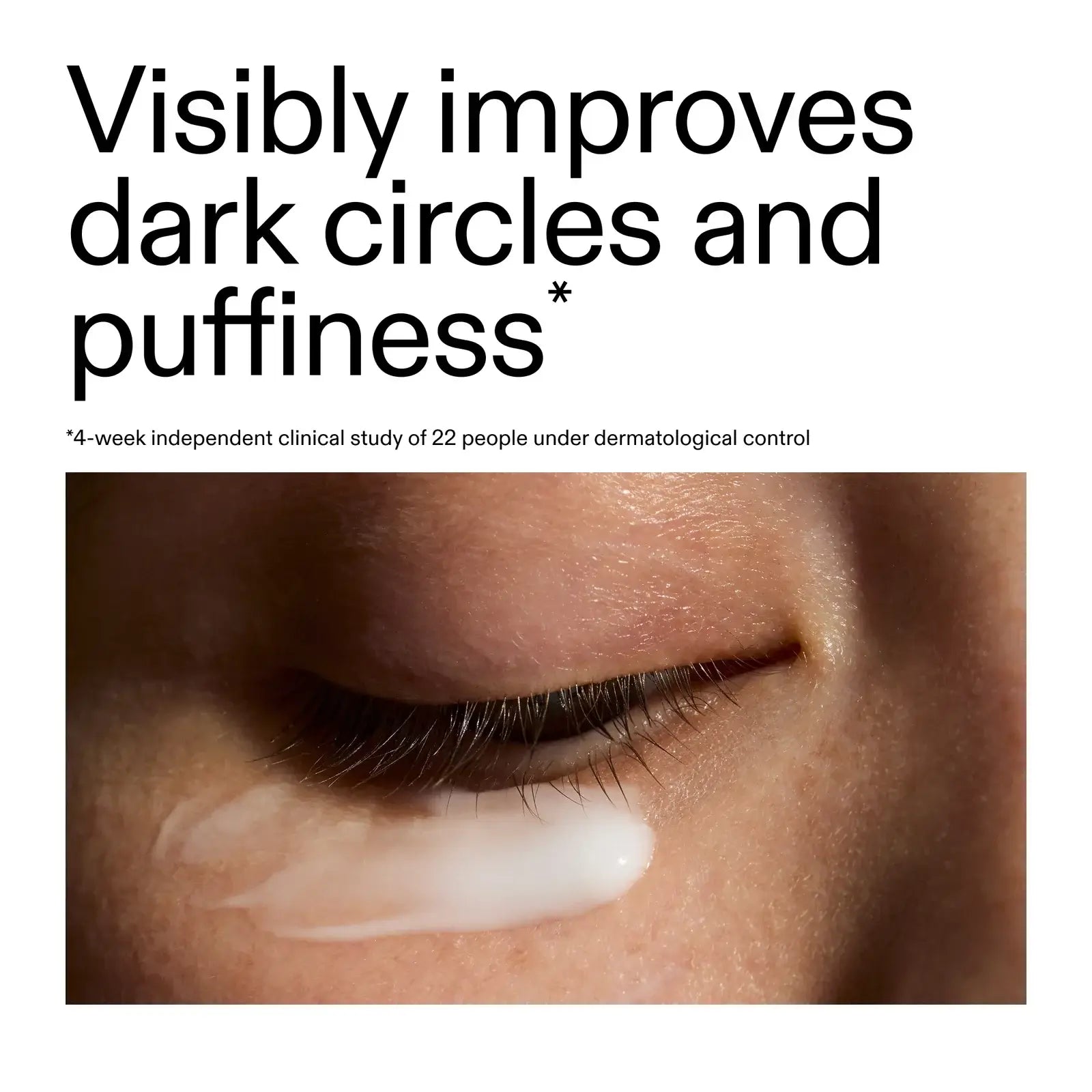 Close-up of an eye with cream applied, highlighting improvement of dark circles and puffiness.