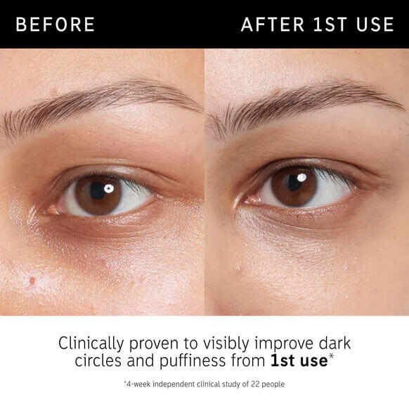 Before and after results of The INKEY List Caffeine Eye Cream showing reduction in dark circles and puffiness.