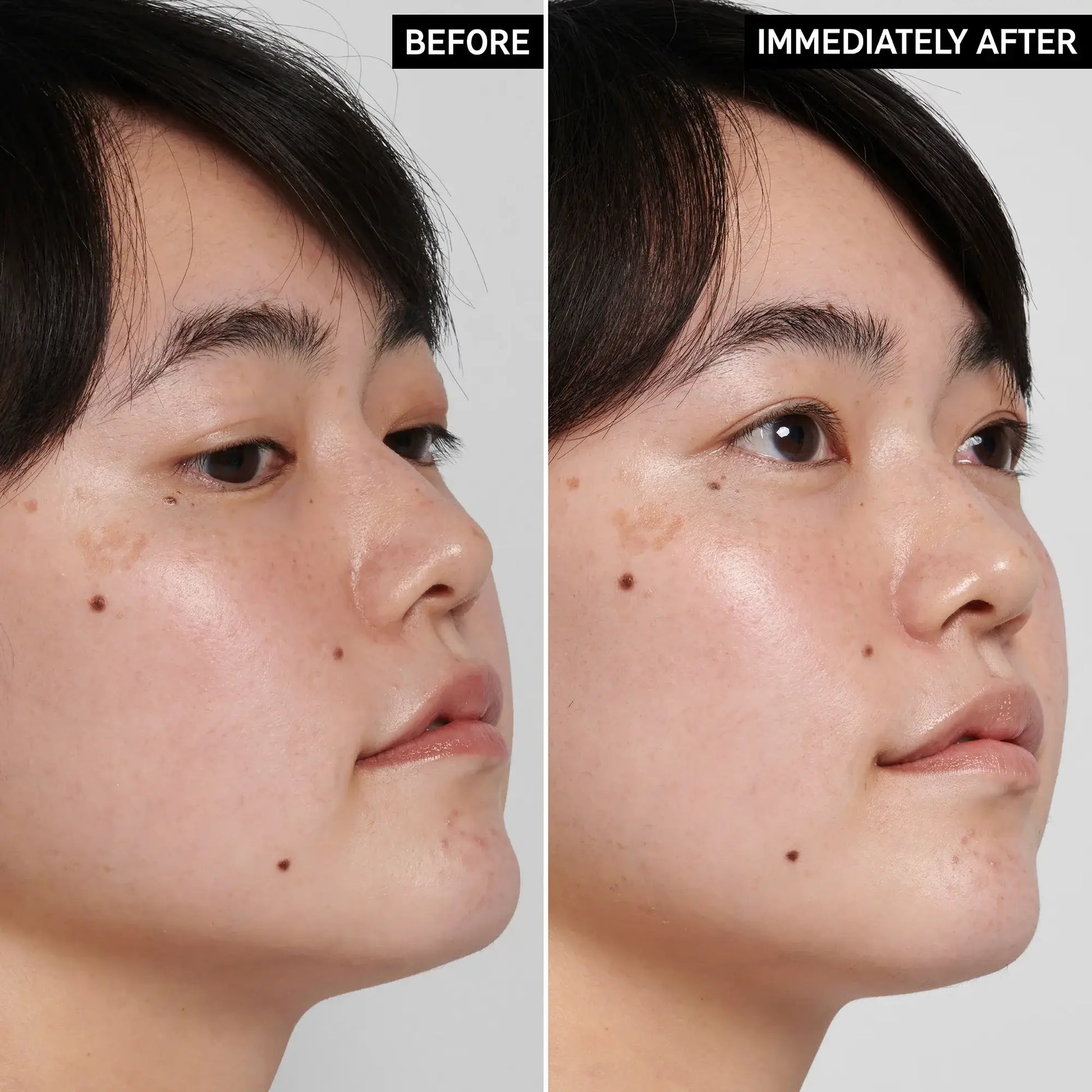 Before and after comparison of skin showing hydration effects after using The INKEY List Hyaluronic Acid Cleanser.