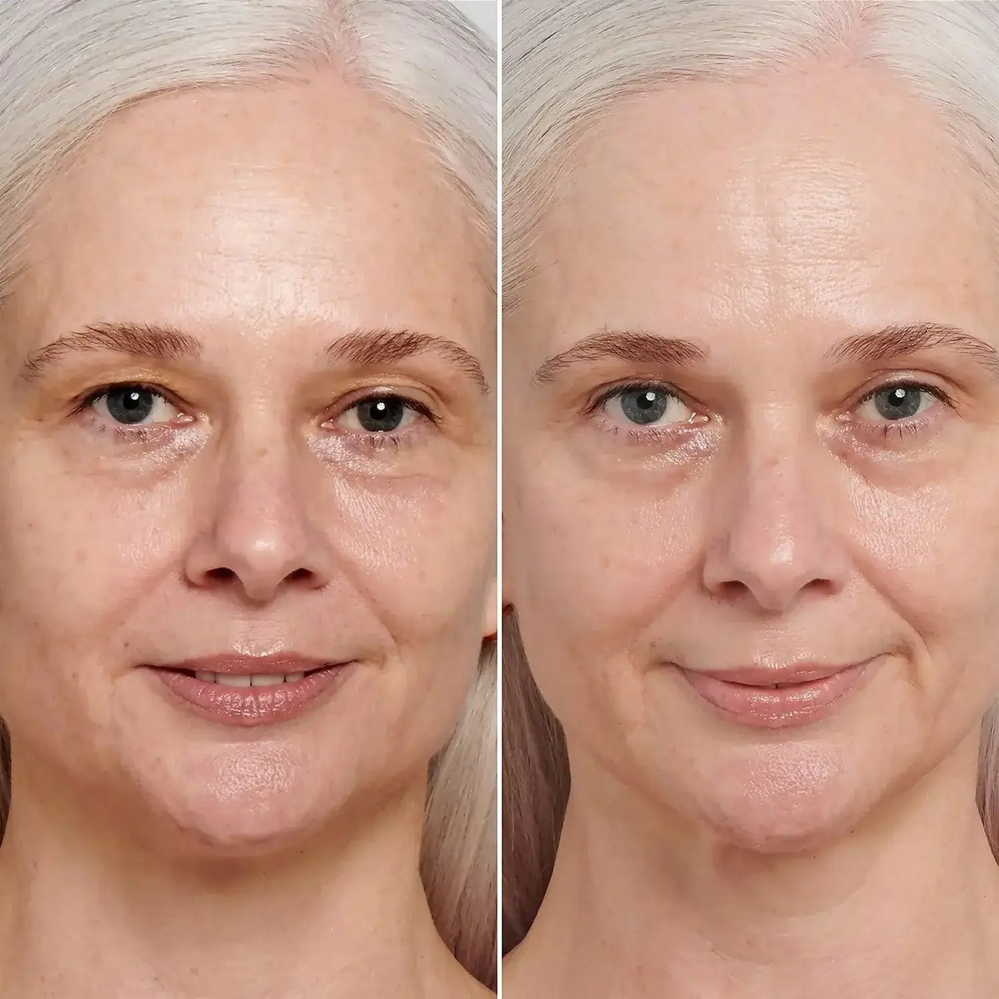 Before and after using retinol serum, showcasing improved skin texture and reduced signs of aging.