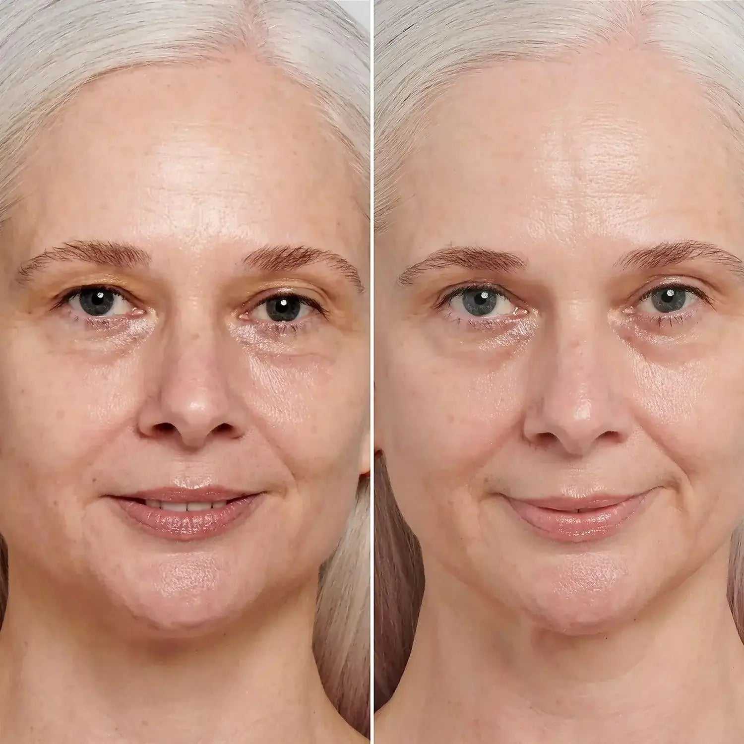 Before and after using retinol serum, showcasing improved skin texture and reduced signs of aging.