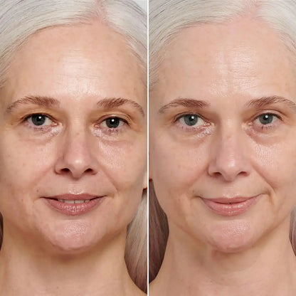 Before and after using retinol serum, showcasing improved skin texture and reduced signs of aging.
