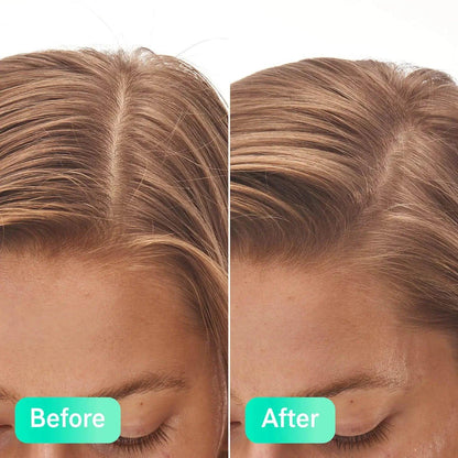 Before and after results of The INKEY List Salicylic Acid Exfoliating Scalp Treatment on hair.