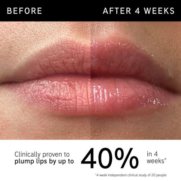Before and after image showing lips plumped by up to 40% in 4 weeks with The INKEY List Tripeptide Plumping Lip Balm.
