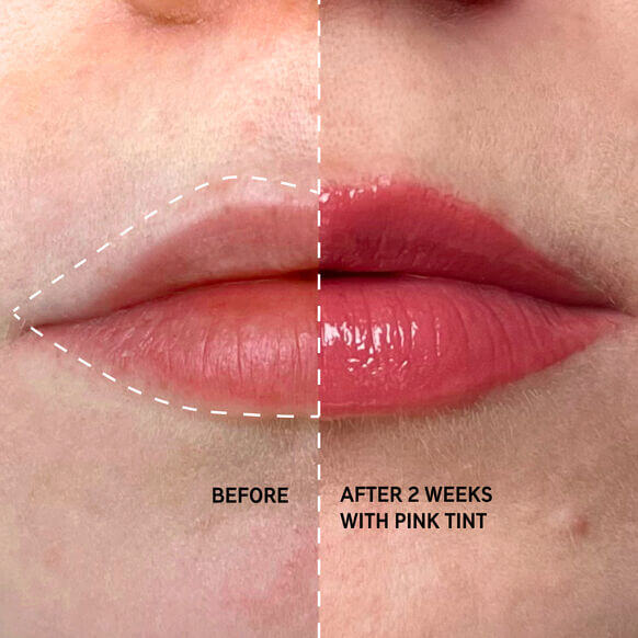 Before and after photo of lips showing results after 2 weeks of using The INKEY List Tripeptide Plumping Lip Balm with pink tint.