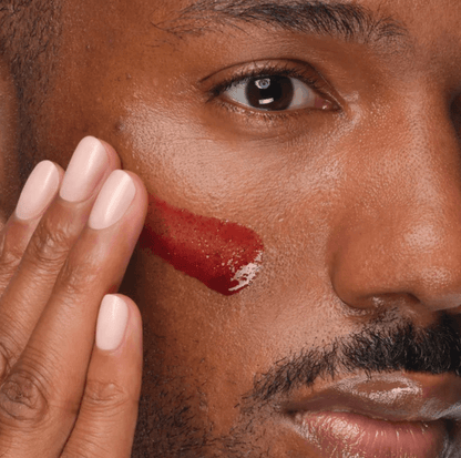 A person applying The Ordinary AHA 30% + BHA 2% Peeling Solution to their face for exfoliation.