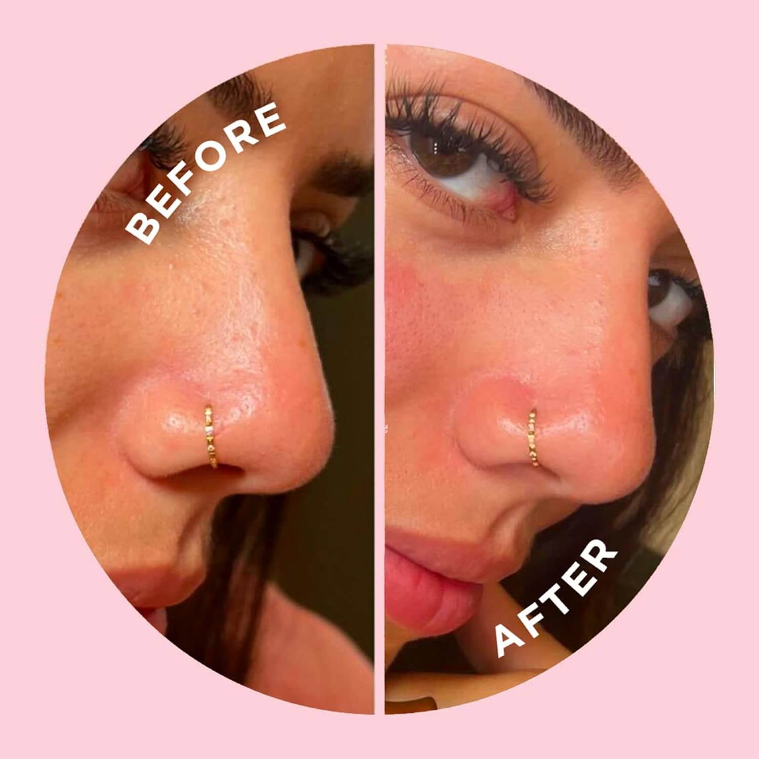 Before and after comparison of a nose with a gold hoop earring on a pink background