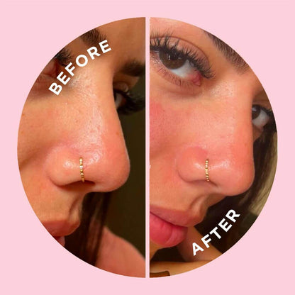 Before and after comparison of a nose with a gold hoop earring on a pink background