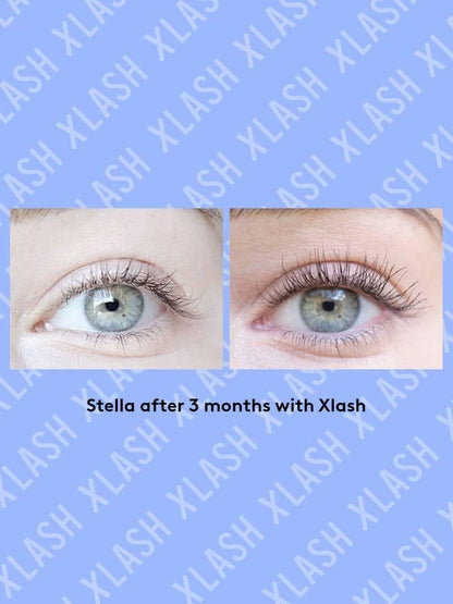 XLash Eye Lash Serum Pro 6ml LYBC